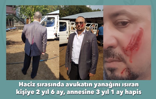 Haciz sırasında avukatın yanağını ısıran kişiye 2 yıl 6 ay, annesine 3 yıl 1 ay hapis